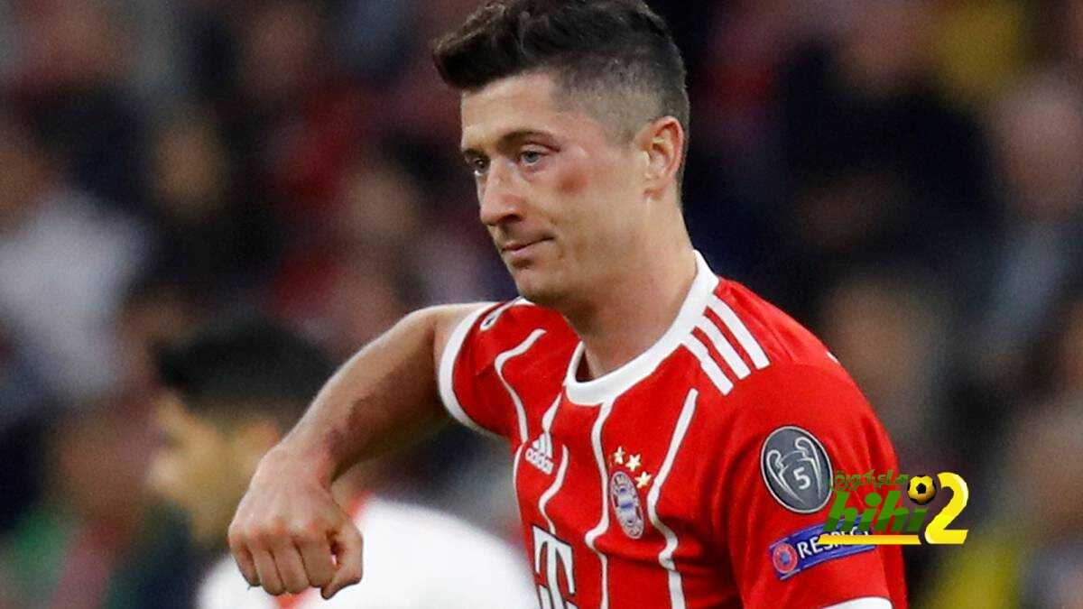 صورة : ليفاندوفيسكي المتورم العين يسخر من قرار كولوم
