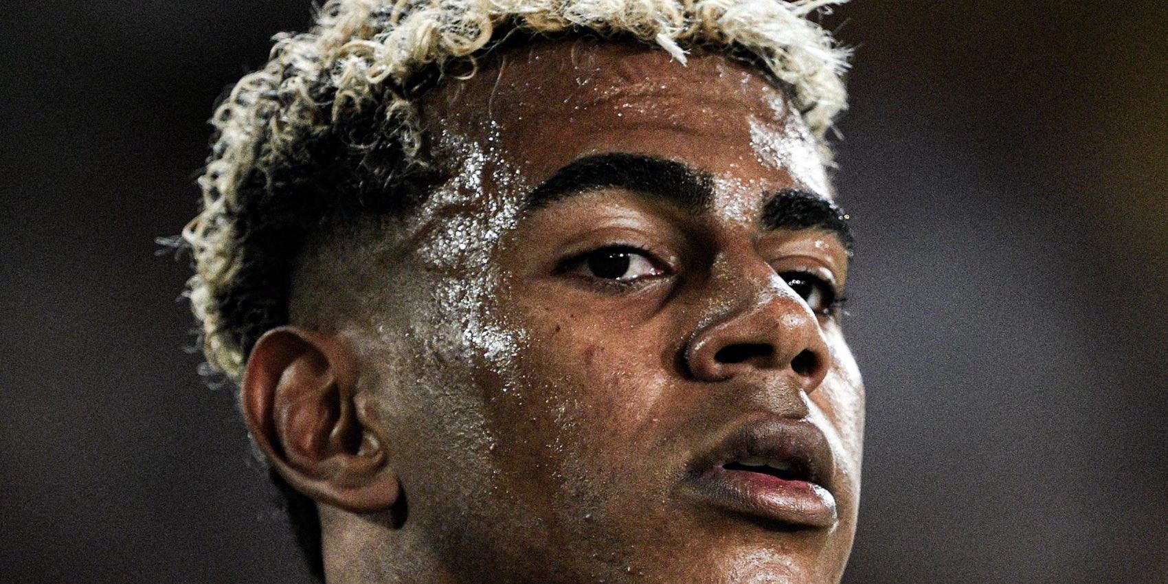 هناك شيء غير منطقي في إصابة لامين المفاجئة…!