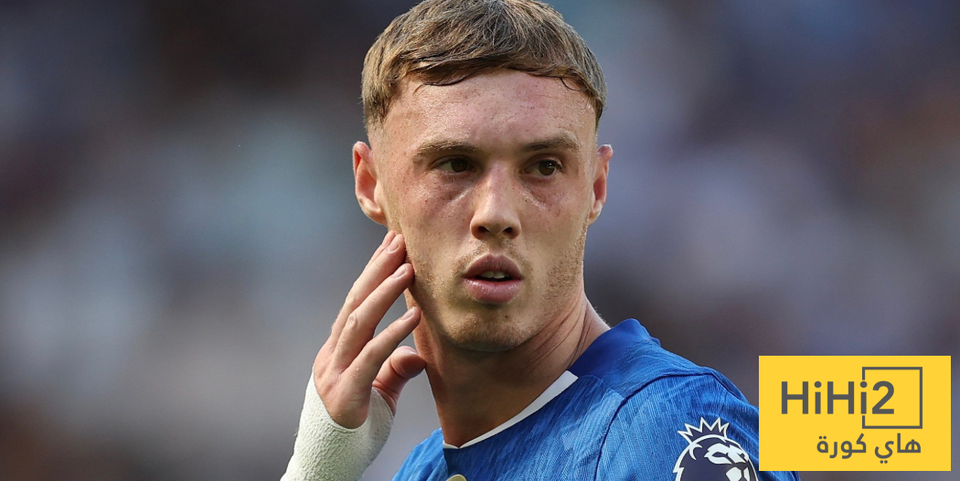 ماريسكا يكشف تطورات إصابة بالمر