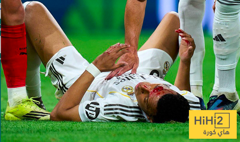 الكشف عن سبب اصابة كليان مبابي …! ” يجب ان يعاقب لانه يمارس التمثيل “