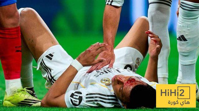 صورة – مبابي يكشف عن تفاصيل إصابته في الوجه