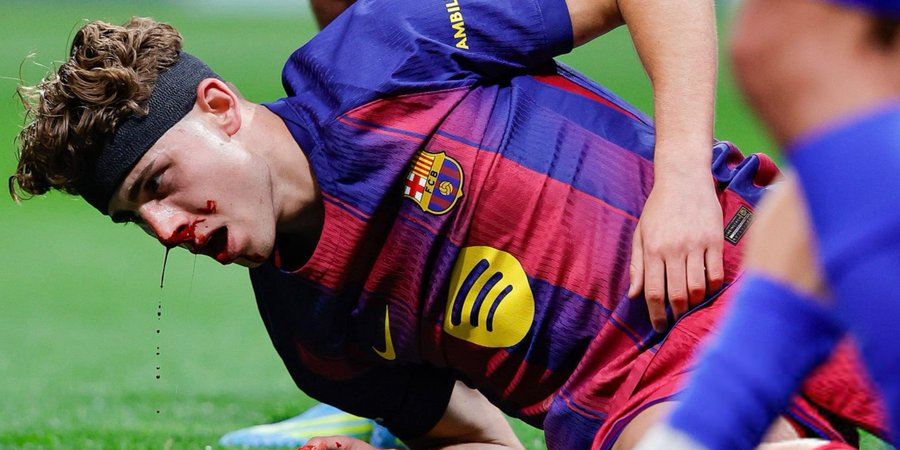 لحظات قاسية لفيرمين بعد اصابته بالوجه