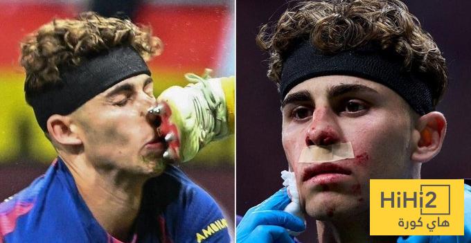 ماذا حدث مع فيرمين بعد انتهاء مباراة اتلتيكو مدريد ؟ ماذا حدث مع فيرمين بعد انتهاء مباراة اتلتيكو مدريد ؟